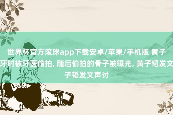 世界杯官方滚球app下载安卓/苹果/手机版 黄子韬看牙时被牙医偷拍, 随后偷拍的骨子被曝光, 黄子韬发文声讨